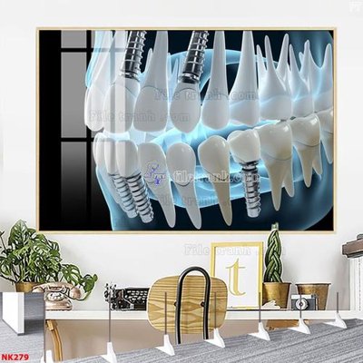File ảnh gốc File gốc tranh in nha khoa NK279 không vỡ nét