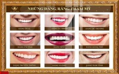 File tranh file tranh in treo tường file decor tổng hợp R5085 (gốc) chủ đề tĩnh vật