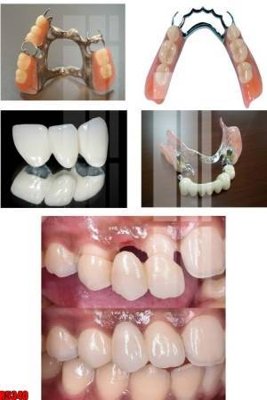 Download file gốc file tranh in treo tường file decor tổng hợp R5340 (in mica) logo