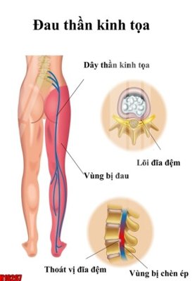 Ảnh gốc file in lụa File tranh gốc in tranh tường nền tổng hợp H16267 chi tiết
