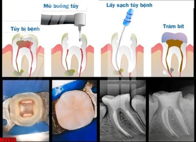 Tải file File tranh gốc in tranh tường nền tổng hợp H16653 (PSD) cho in tranh 3D