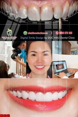 File in trần File tranh gốc in tranh tường nền tổng hợp H34645 (bản gốc) phong cảnh