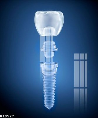 Tải file gốc File gốc in tranh tổng hợp K19527 (in khổ lớn) quảng cáo