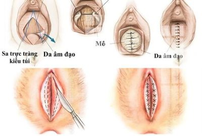 File ảnh File gốc in tranh tổng hợp K26176 (gốc) cho trang trí nhà hàng