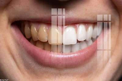 Hình ảnh file gốc in trần nhà File gốc in tranh tổng hợp K26767