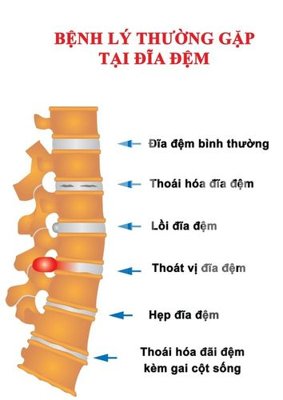 File tranh File gốc in tranh tổng hợp Q13465 (gốc) chủ đề con người