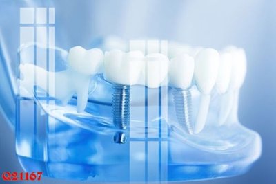 Chi tiết file ảnh File gốc in tranh tổng hợp Q21167 sắc nét