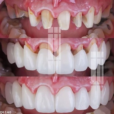 File tranh quảng cáo File gốc in tranh tổng hợp Q6140 (file gốc) chuyên nghiệp