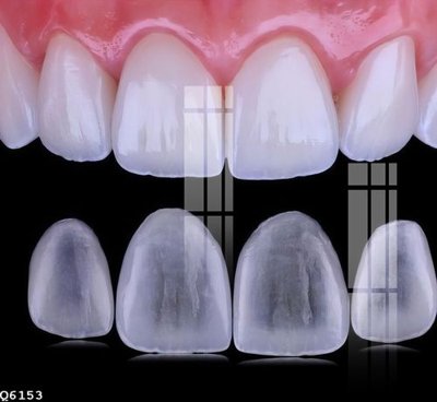 File tranh gốc File gốc in tranh tổng hợp Q6153 (bản quyền) Filetranh.com